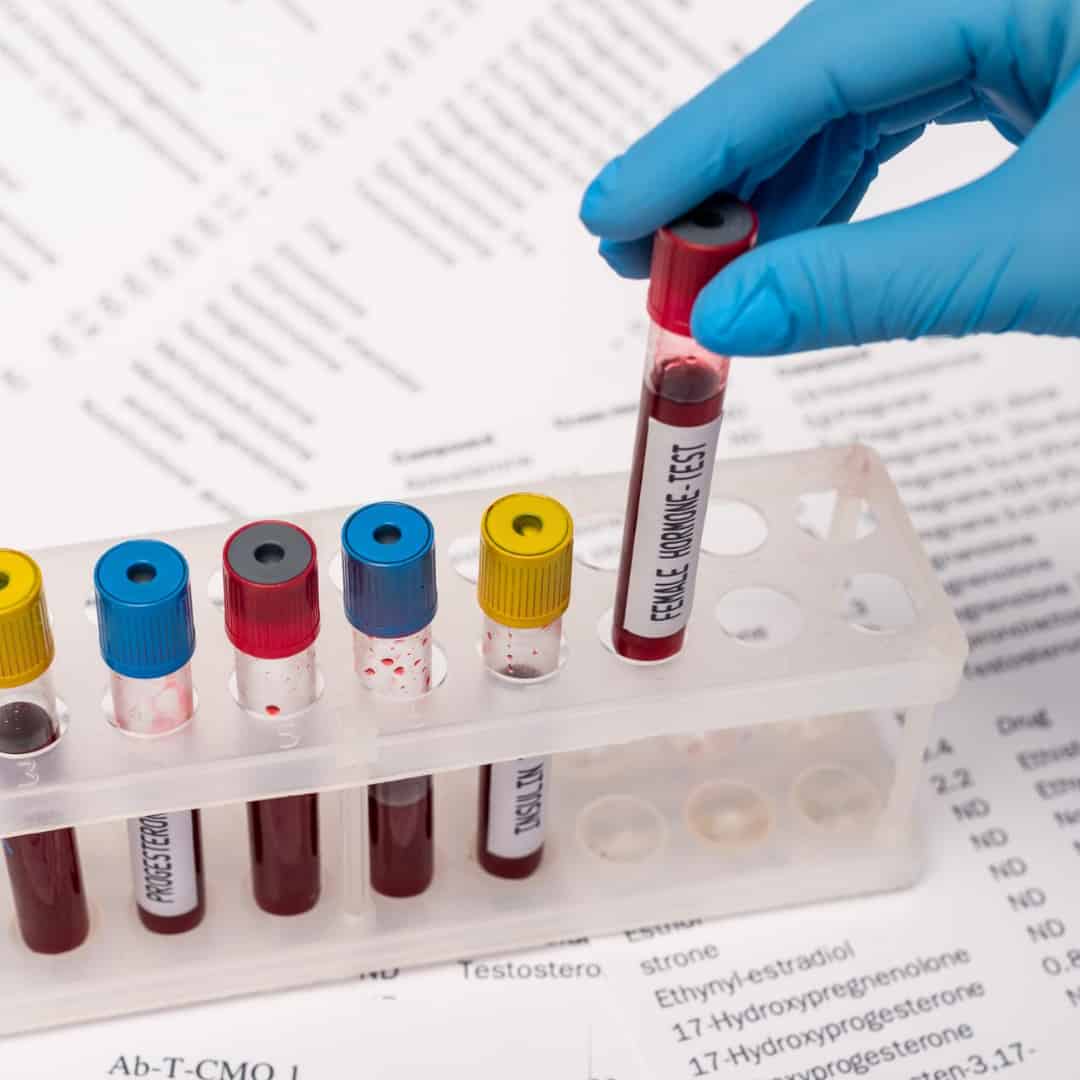 A hand with blue gloves holding a blood sample. A hand with blue gloves holding a blood sample.